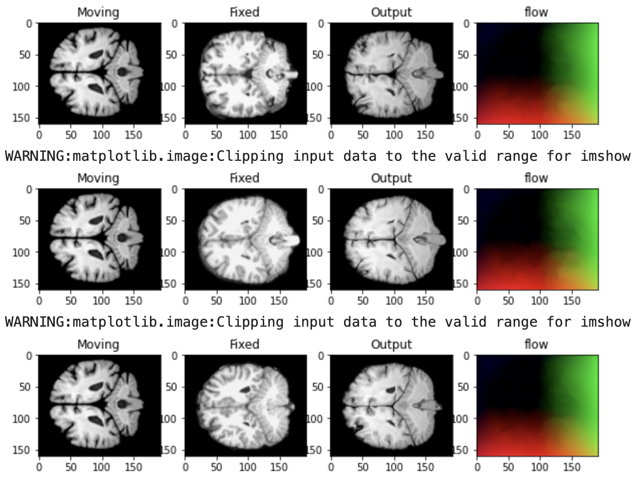 Image for MRI Morph